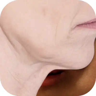 Подбородок