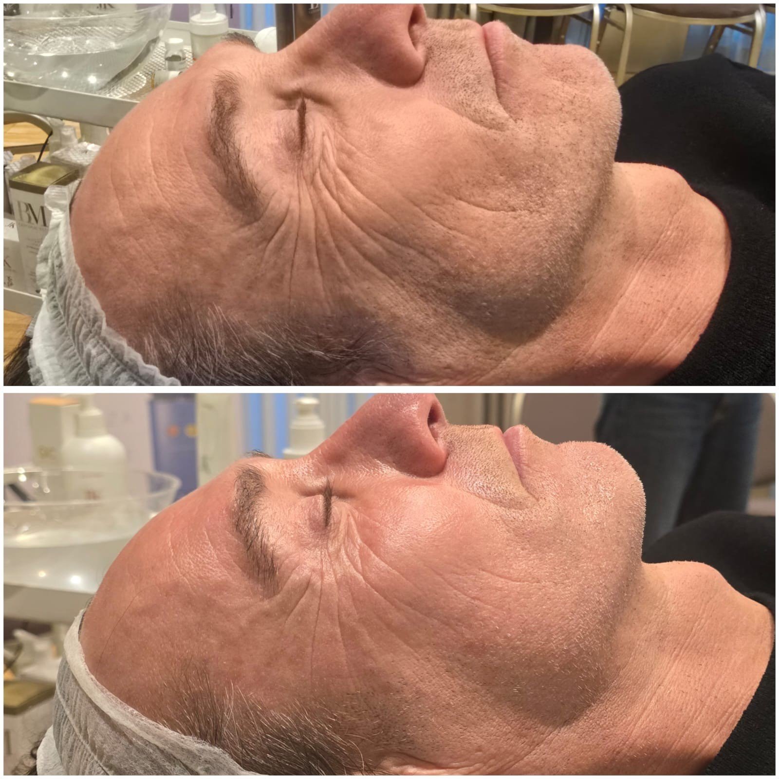 esosomic una sesion 3