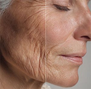 regenerative medicine