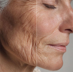 regenerative medicine